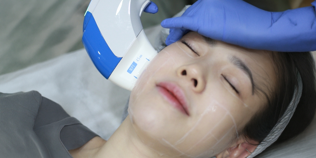 Pipi Mulai Terlihat Turun Tapi Belum Siap Tanam Benang? Ini Cara Menentukan Apakah HIFU Lift Treatment Sudah Cukup