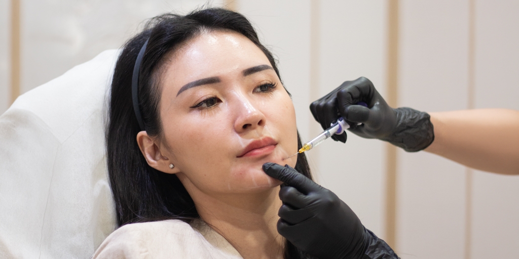 Garis Halus Muncul Saat Senyum di Umur 20-an? Kapan Botox Bisa Dipertimbangkan