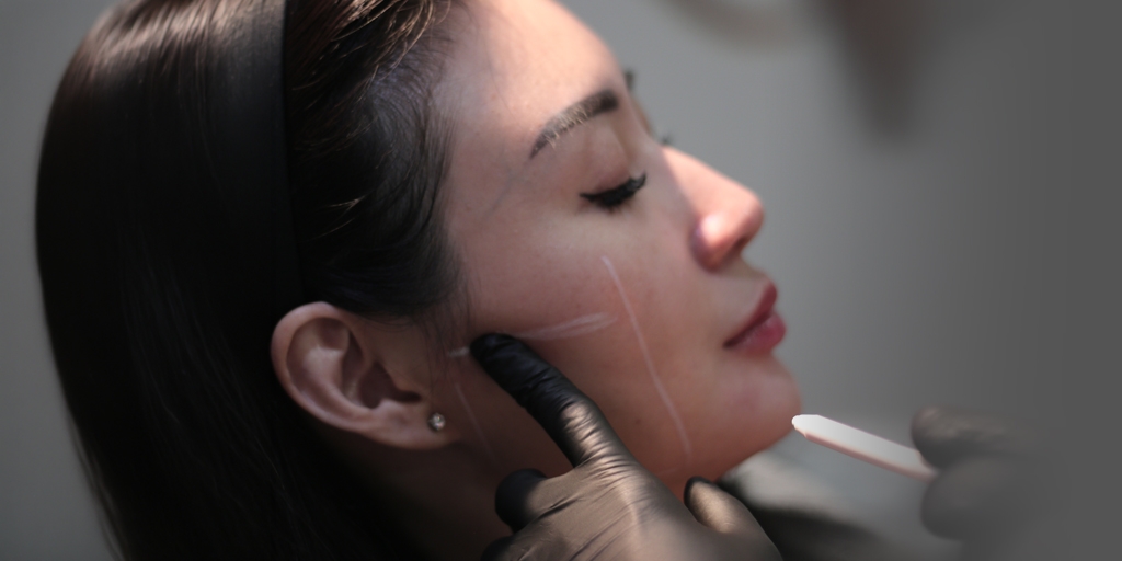 Ingin Jawline Lebih Tegas? Ini Cara Memilih antara Ultherapy dan Thread Lift