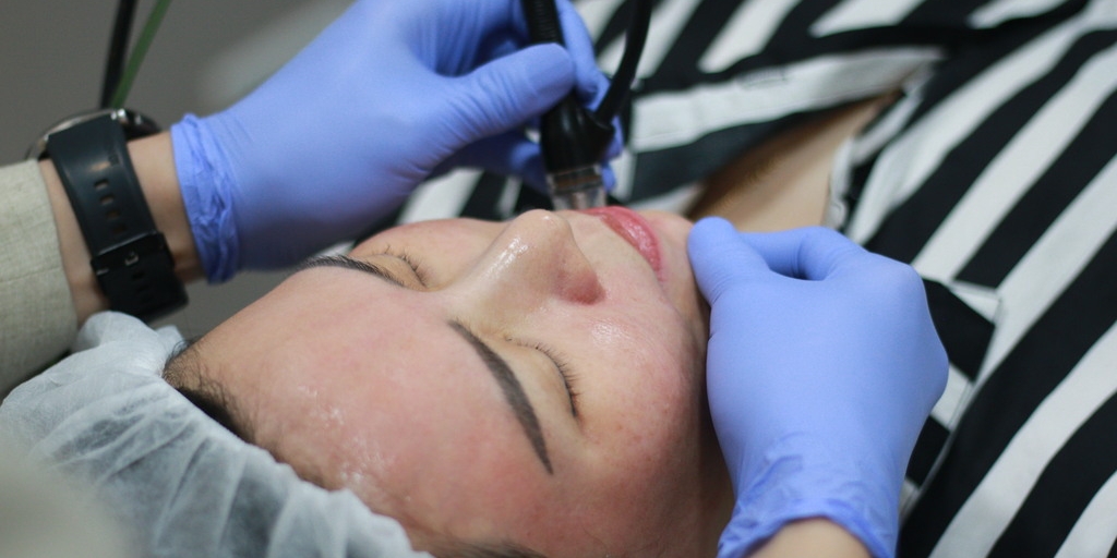 Pendekatan Menyeluruh Miracle Aesthetic Clinic, Tangani Hiperpigmentasi Kulit Pelanggan Indonesia