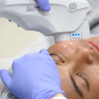 Banner Ultherapy Preventive Aging sebelum 40