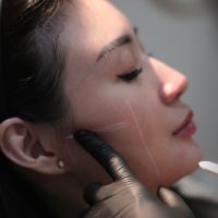 Banner Ingin Jawline Lebih Tegas? Ini Cara Memilih antara Ultherapy dan Thread Lift